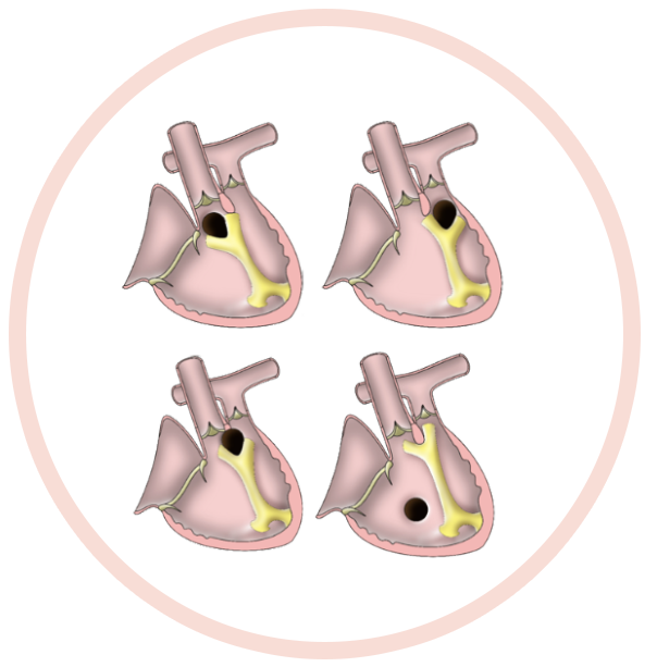 HOC-Image-Buttons.006-circle